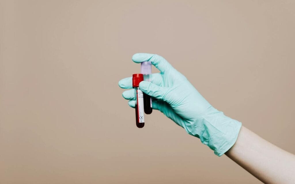 Calculadora Volemia e Hemoglobina